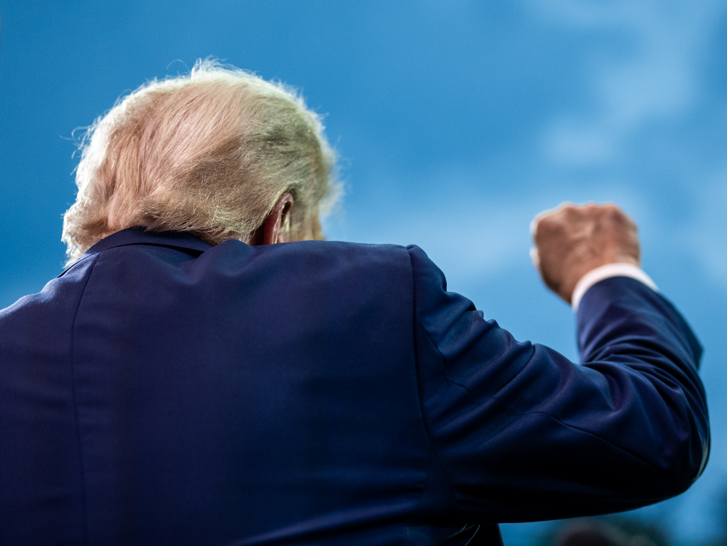 White House Confirms Trump’s Chronic Venous Insufficiency After Leg Swelling
